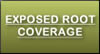 Exposed Root Coverage