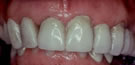 Before pic